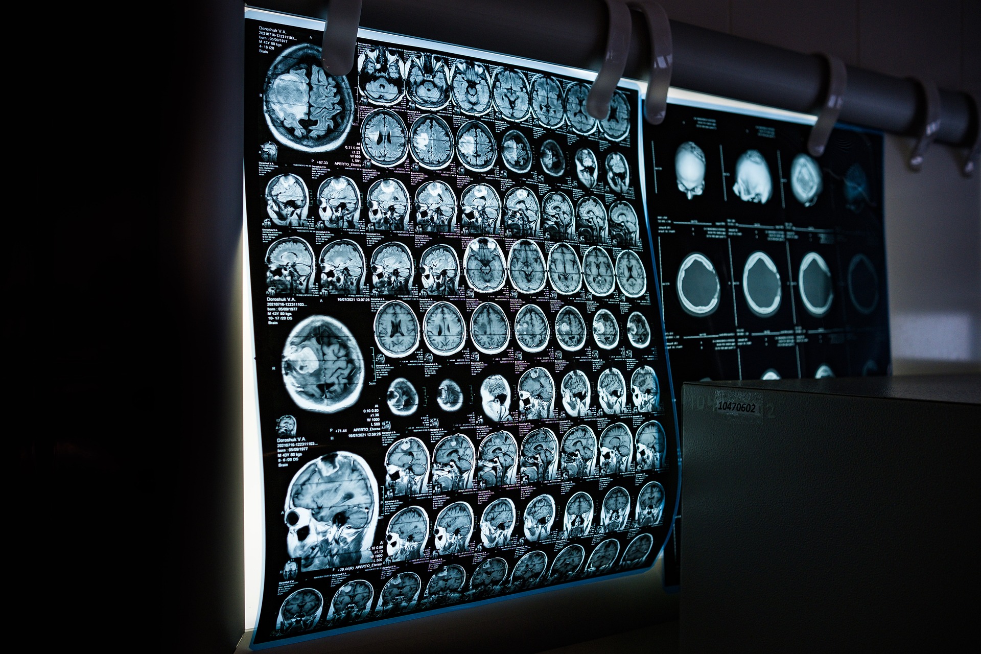 neurološka oboljenja neurološka oboljenja